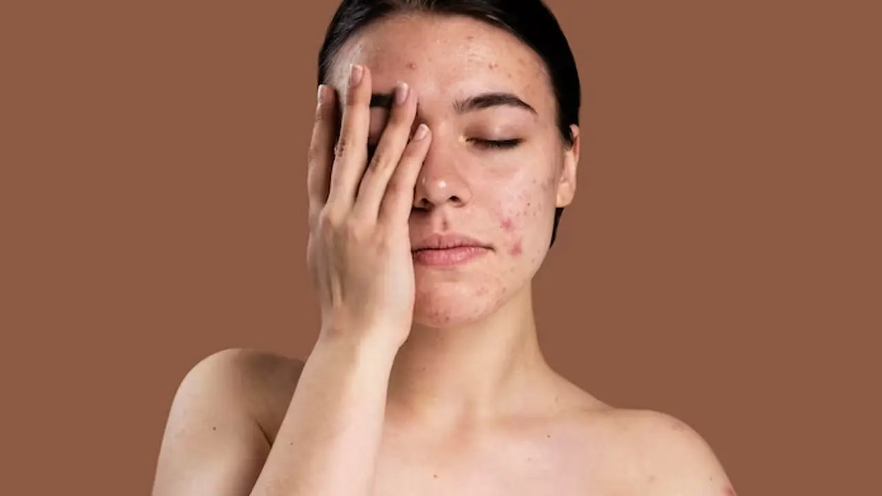 Unveiling the Mystery: Skinny Shot Side Effects